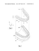 TOOTH POSITIONING APPLIANCE WITH CURVED INTERCONNECTING ELEMENTS diagram and image