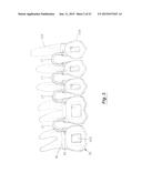 TOOTH POSITIONING APPLIANCE WITH CURVED INTERCONNECTING ELEMENTS diagram and image