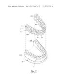 TOOTH POSITIONING APPLIANCE WITH CURVED INTERCONNECTING ELEMENTS diagram and image