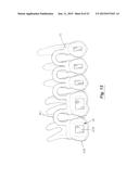 TOOTH POSITIONING APPLIANCE WITH CURVED INTERCONNECTING ELEMENTS diagram and image