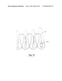 TOOTH POSITIONING APPLIANCE WITH CURVED INTERCONNECTING ELEMENTS diagram and image