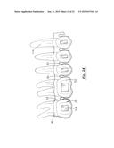 TOOTH POSITIONING APPLIANCE WITH CURVED INTERCONNECTING ELEMENTS diagram and image