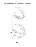 TOOTH POSITIONING APPLIANCE WITH CURVED INTERCONNECTING ELEMENTS diagram and image