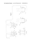 TOOTH POSITIONING APPLIANCE WITH CURVED INTERCONNECTING ELEMENTS diagram and image