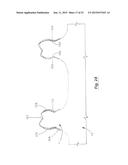 TOOTH POSITIONING APPLIANCE WITH CURVED INTERCONNECTING ELEMENTS diagram and image