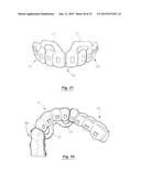 TOOTH POSITIONING APPLIANCE WITH CURVED INTERCONNECTING ELEMENTS diagram and image