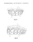 TOOTH POSITIONING APPLIANCE WITH CURVED INTERCONNECTING ELEMENTS diagram and image