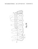 TOOTH POSITIONING APPLIANCE WITH CURVED INTERCONNECTING ELEMENTS diagram and image