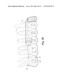 TOOTH POSITIONING APPLIANCE WITH CURVED INTERCONNECTING ELEMENTS diagram and image