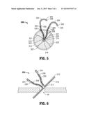 HERNIA REPAIR DEVICE AND METHOD diagram and image