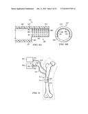 MANIFOLDS, SYSTEMS, AND METHODS FOR ADMINISTERING REDUCED PRESSURE TO A     SUBCUTANEOUS TISSUE SITE diagram and image