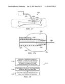 MANIFOLDS, SYSTEMS, AND METHODS FOR ADMINISTERING REDUCED PRESSURE TO A     SUBCUTANEOUS TISSUE SITE diagram and image