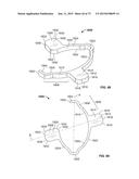 ATTACHMENT MECHANISM FOR A CONTAINER diagram and image