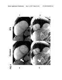 Accuracy and Off-Resonance Performance in Quantitative Magnetization     Prepared Magnetic Resonance Imaging diagram and image