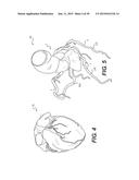 METHOD AND SYSTEM FOR PATIENT-SPECIFIC MODELING OF BLOOD FLOW diagram and image