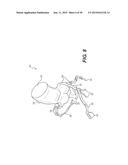 METHOD AND SYSTEM FOR PATIENT-SPECIFIC MODELING OF BLOOD FLOW diagram and image