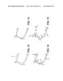 METHOD AND SYSTEM FOR PATIENT-SPECIFIC MODELING OF BLOOD FLOW diagram and image