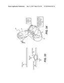 METHOD AND SYSTEM FOR PATIENT-SPECIFIC MODELING OF BLOOD FLOW diagram and image