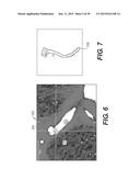 METHOD AND SYSTEM FOR PATIENT-SPECIFIC MODELING OF BLOOD FLOW diagram and image