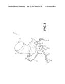 METHOD AND SYSTEM FOR PATIENT-SPECIFIC MODELING OF BLOOD FLOW diagram and image