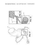 METHOD AND SYSTEM FOR PATIENT-SPECIFIC MODELING OF BLOOD FLOW diagram and image