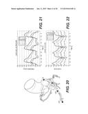 METHOD AND SYSTEM FOR PATIENT-SPECIFIC MODELING OF BLOOD FLOW diagram and image