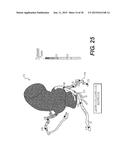 METHOD AND SYSTEM FOR PATIENT-SPECIFIC MODELING OF BLOOD FLOW diagram and image