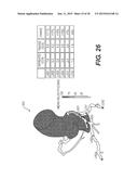 METHOD AND SYSTEM FOR PATIENT-SPECIFIC MODELING OF BLOOD FLOW diagram and image