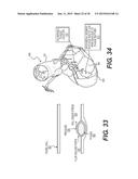 METHOD AND SYSTEM FOR PATIENT-SPECIFIC MODELING OF BLOOD FLOW diagram and image