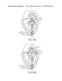 PROSTHETIC HEART VALVE DEVICES, PROSTHETIC MITRAL VALVES AND ASSOCIATED     SYSTEMS AND METHODS diagram and image