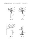 IMPLANTABLE SCAFFOLDING CONTAINING AN ORIFICE FOR USE WITH A PROSTHETIC OR     BIO-PROSTHETIC VALVE diagram and image