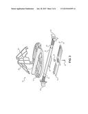 Portable Speed Bag Retention Mechanism diagram and image