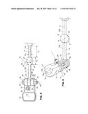 Spacer Device diagram and image