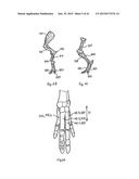 SYSTEM FOR CONVEYING CARCASSES OR CARCASS PARTS OF QUADRUPED SLAUGHTER     ANIMALS diagram and image