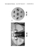 INTEGRATION OF QUANTITATIVE CALIBRATION SYSTEMS IN COMPUTED TOMOGRAPHY     SCANNERS diagram and image