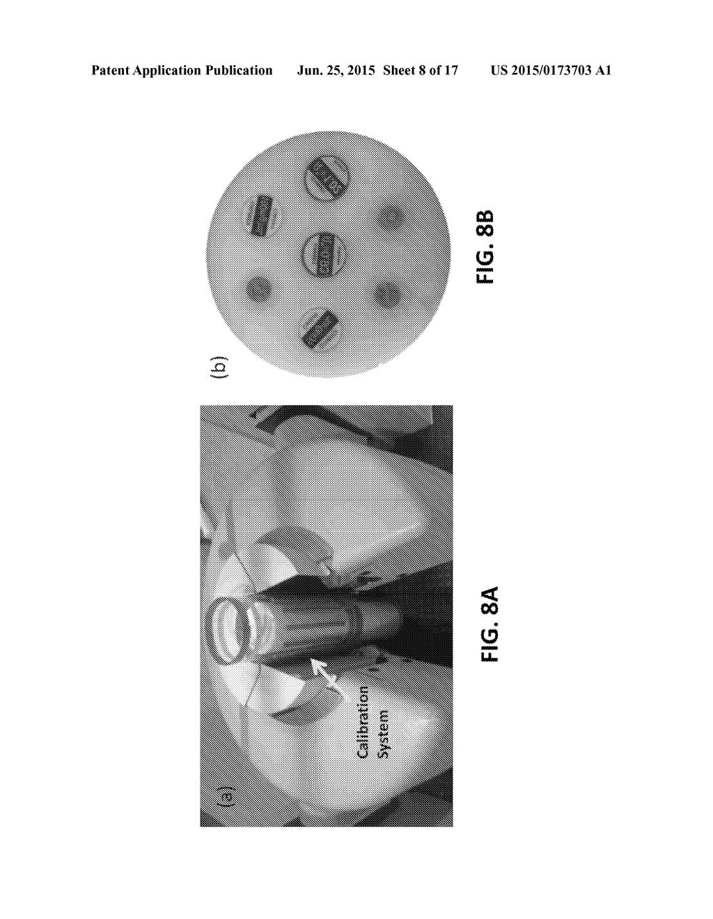 INTEGRATION OF QUANTITATIVE CALIBRATION SYSTEMS IN COMPUTED TOMOGRAPHY     SCANNERS - diagram, schematic, and image 09