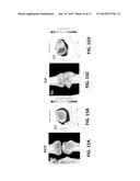 INTEGRATION OF QUANTITATIVE CALIBRATION SYSTEMS IN COMPUTED TOMOGRAPHY     SCANNERS diagram and image