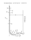 Retractor Tool For Minimally Invasive Hip Replacement Surgery diagram and image