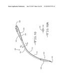 Retractor Tool For Minimally Invasive Hip Replacement Surgery diagram and image