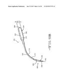 Retractor Tool For Minimally Invasive Hip Replacement Surgery diagram and image