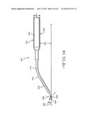 Retractor Tool For Minimally Invasive Hip Replacement Surgery diagram and image