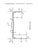 Retractor Tool For Minimally Invasive Hip Replacement Surgery diagram and image