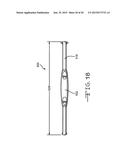 Retractor Tool For Minimally Invasive Hip Replacement Surgery diagram and image