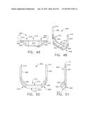 FASTENER CARTRIDGE COMPRISING AN EXTENDABLE FIRING MEMBER diagram and image