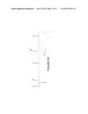 Sandwich-type Gastrointestinal Anastomosis Stapler diagram and image