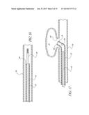 Intracorporeal Occlusive Device And Method diagram and image