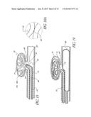 Intracorporeal Occlusive Device And Method diagram and image