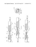 Intracorporeal Occlusive Device And Method diagram and image