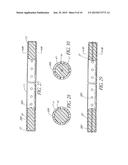 Intracorporeal Occlusive Device And Method diagram and image