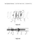 Device Delivery System diagram and image